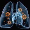 ایجاد پنومونی و COPD در بیماران مبتلا به کرونا
