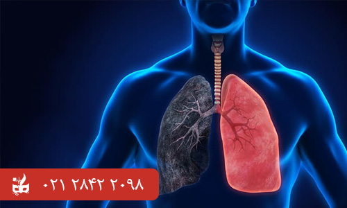 ساختار و نحوه عملکرد دستگاه تنفسی  - انسداد ریوی مزمن (COPD)
