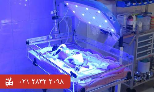 فتوتراپی نوزاد - تجهیزات پزشکی نوزادان