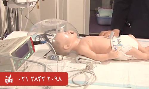 هود نوزاد - تجهیزات پزشکی نوزادان